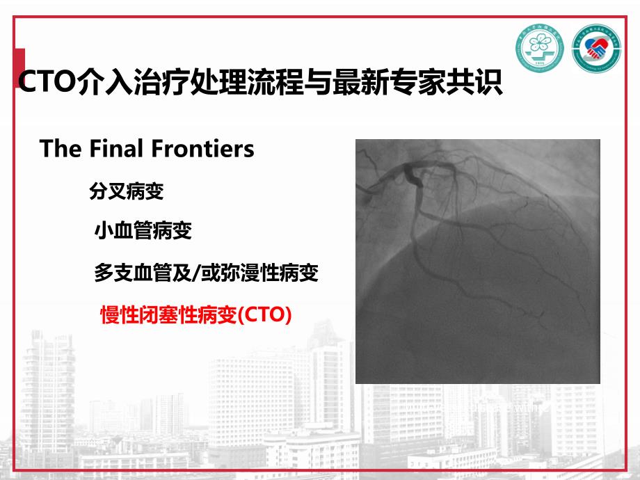 CTO介入治疗处理流程与最新专家共识课件_第1页