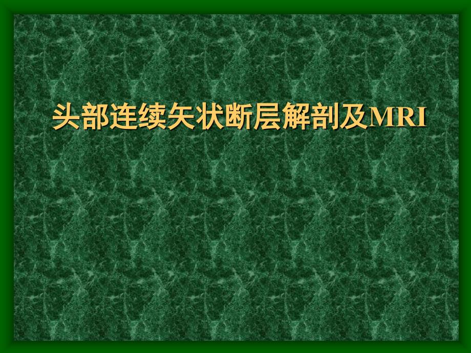 头部连续矢状断层解剖及MRI_第1页