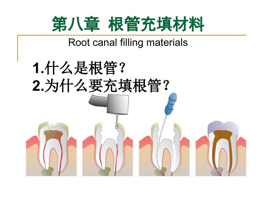 根管充填材料课件_第1页