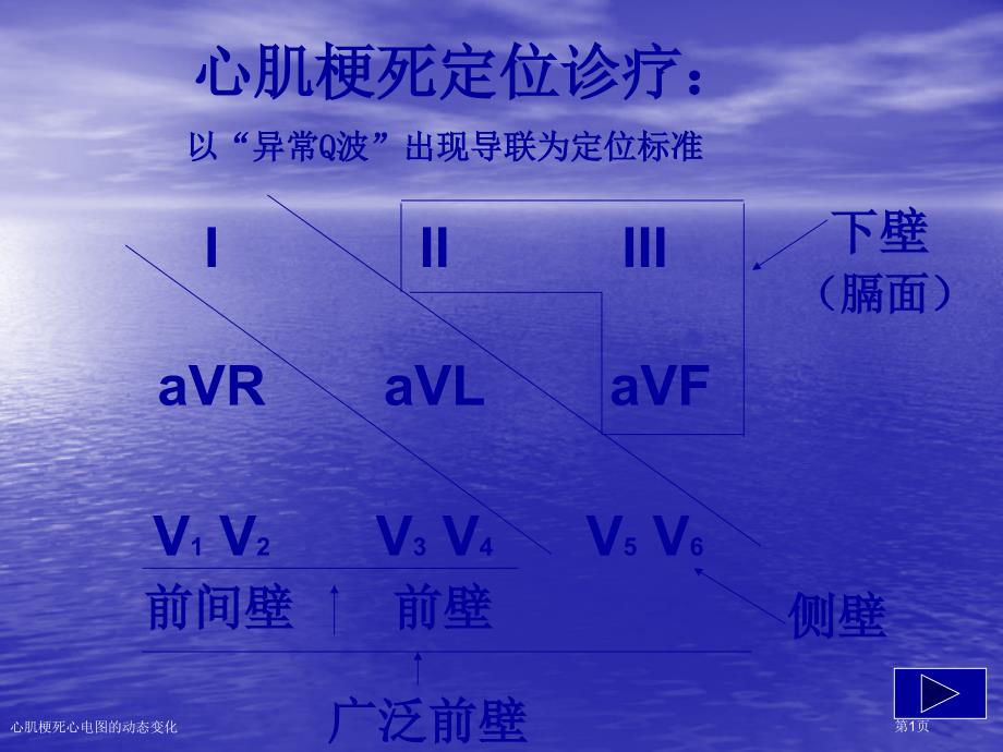 心肌梗死心电图的动态变化_第1页