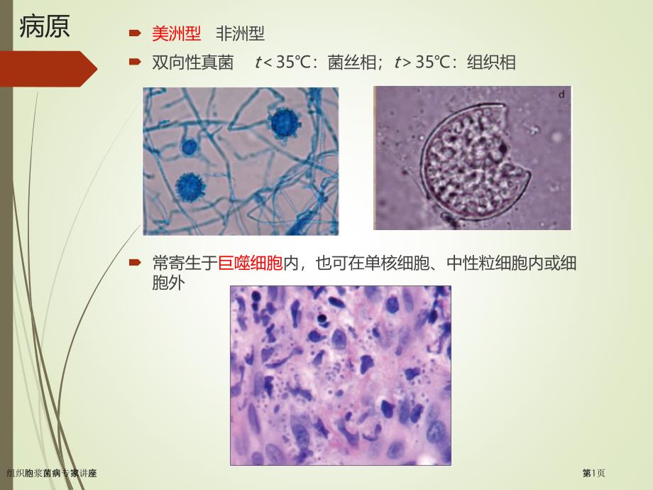 组织胞浆菌病专家讲座_第1页