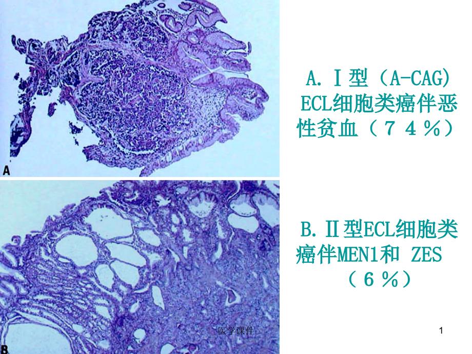 组织病理学--诊断消化-课件_第1页