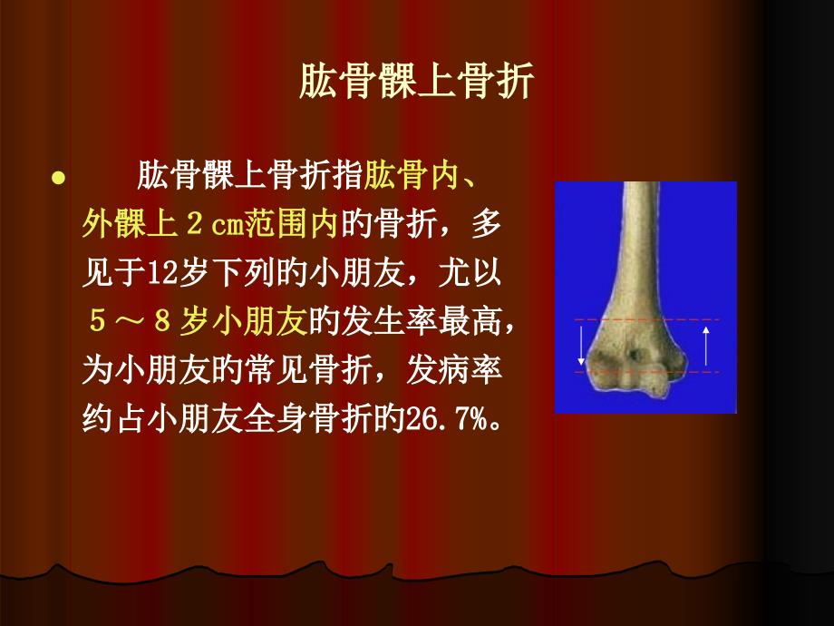 肱骨髁上骨折专业资料_第1页