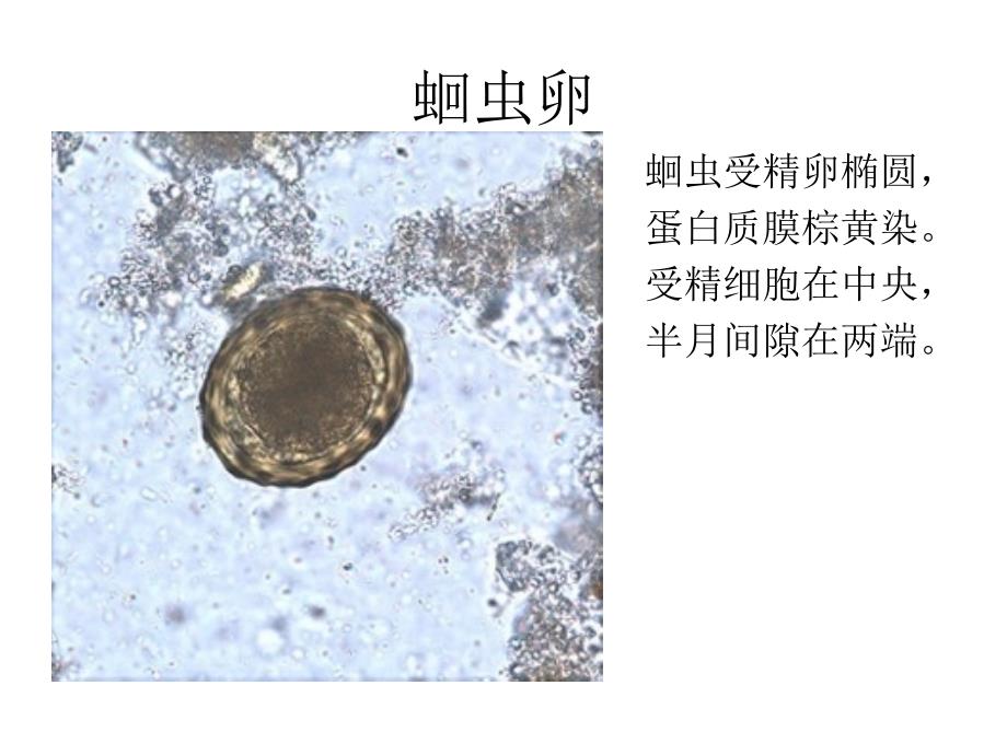 寄生虫学虫卵经典总结和图片_第1页