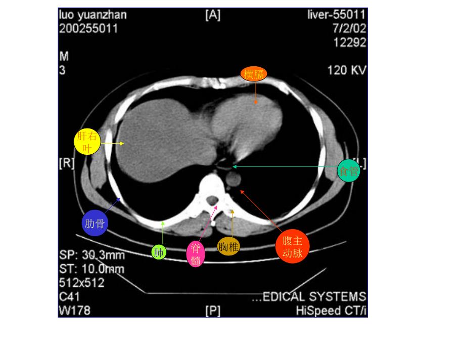 腹部CT详解专题知识_第1页