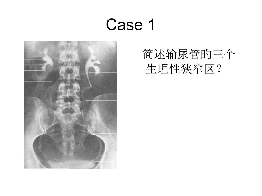 泌尿系常见病多发病_第1页