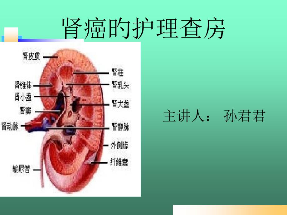 肾癌的医疗护理查房_第1页