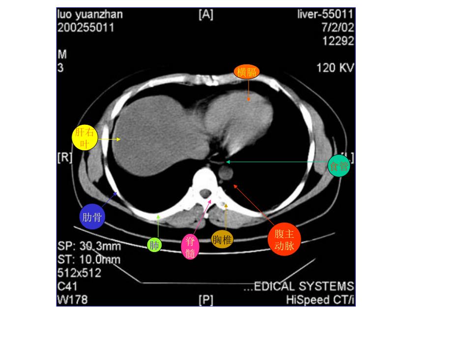 教你如何看腹部CT_第1页