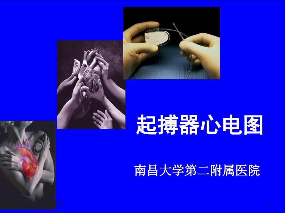 起搏器心电图_第1页