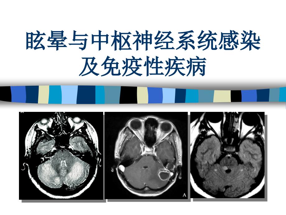 眩晕与中枢神经系统感染及免疫性疾病_第1页