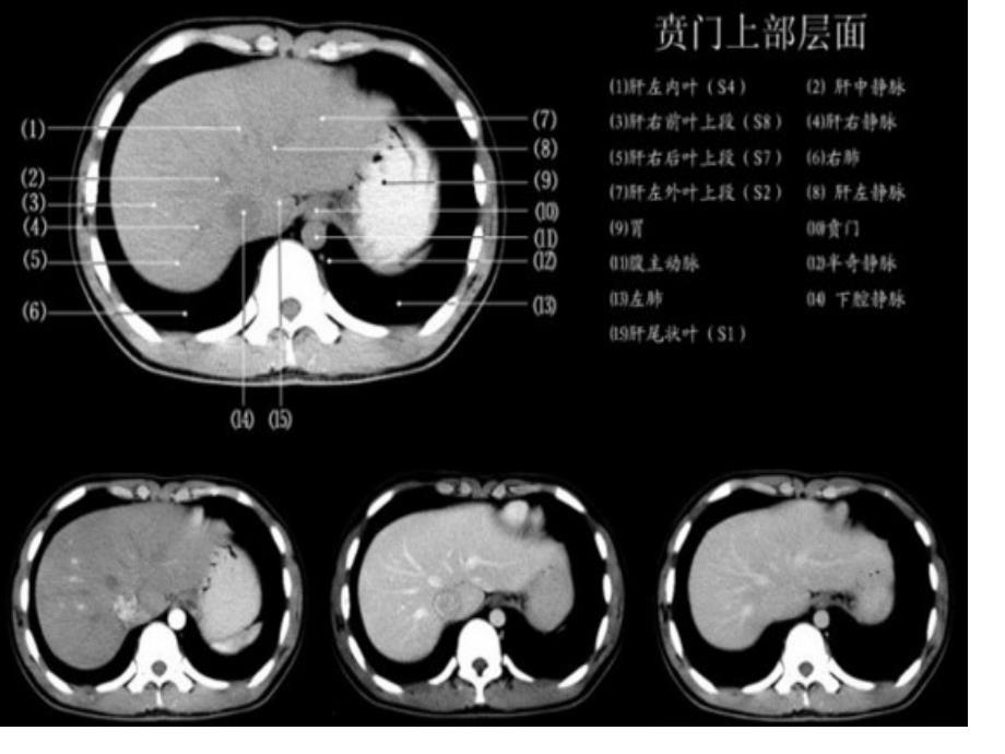 如何读懂腹部CT_第1页