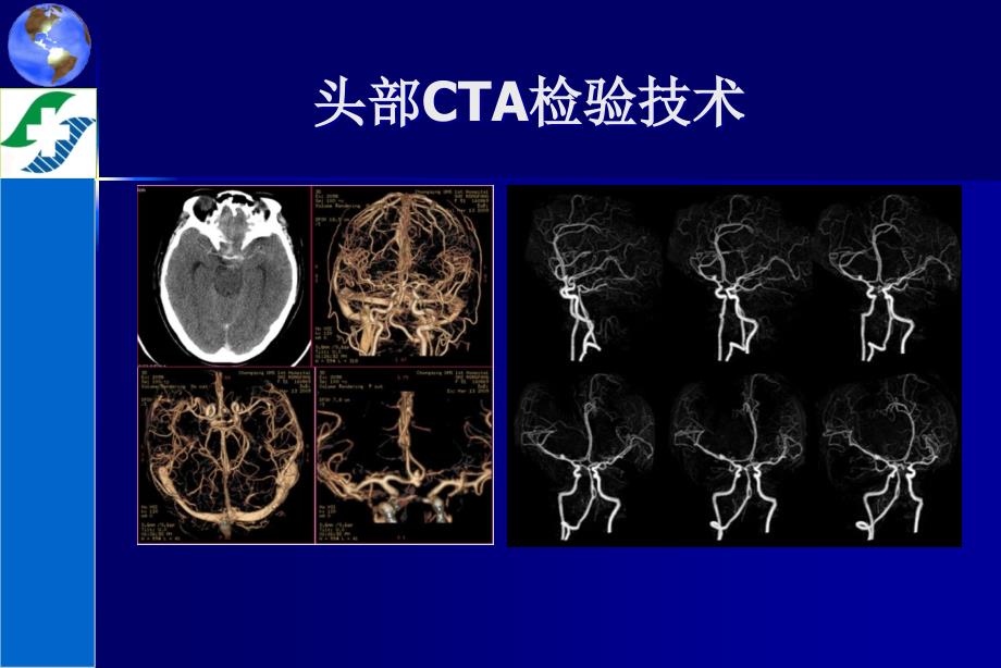 头部CTA检查技术_第1页