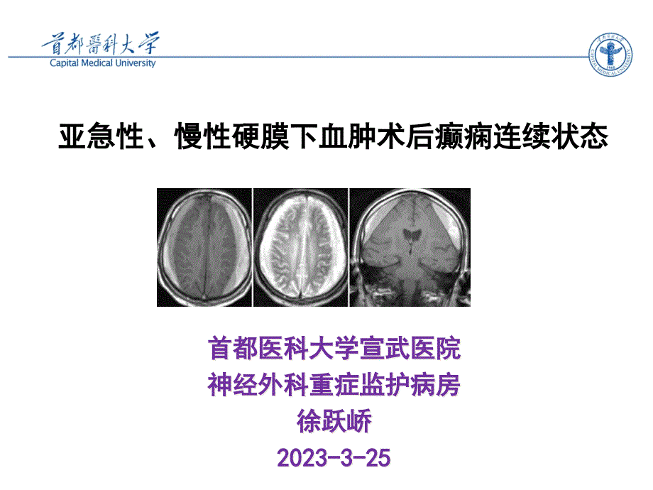 硬膜下血肿术后癫痫持续状态简单专家讲座_第1页