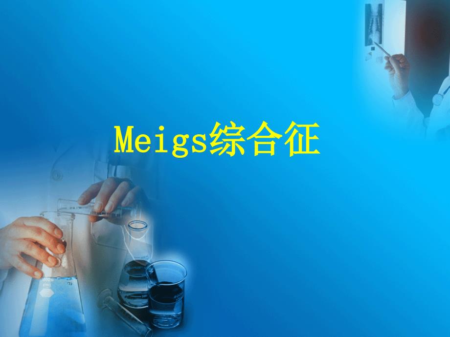 Meigs综合征专题知识_第1页