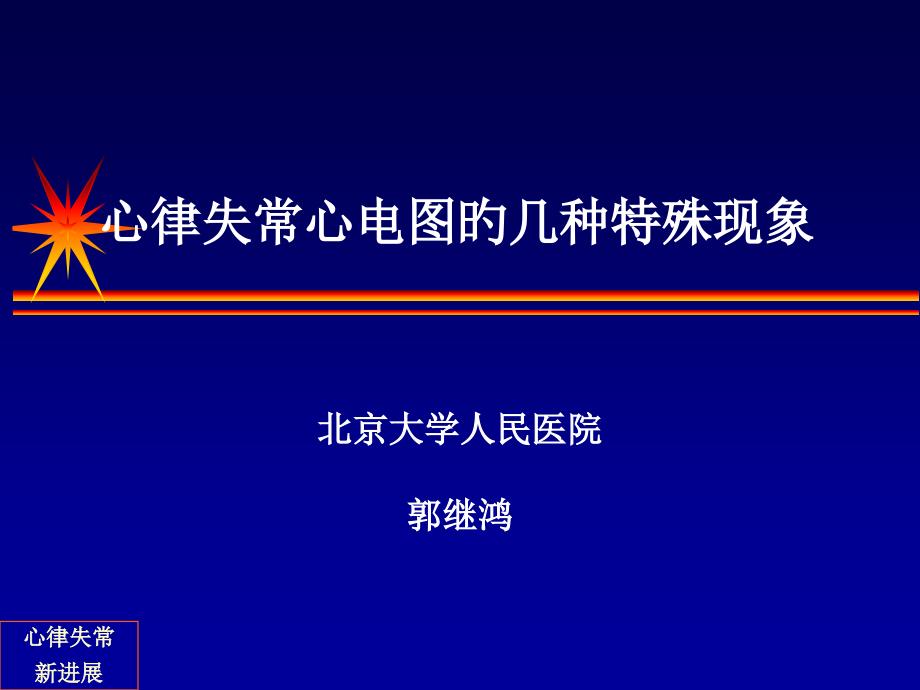 特发性右室流出道室速培训_第1页