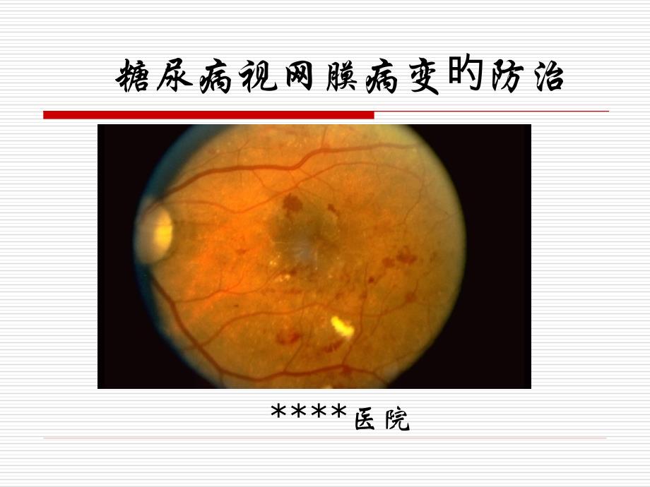 糖尿病视网膜病变宣教专家讲座_第1页