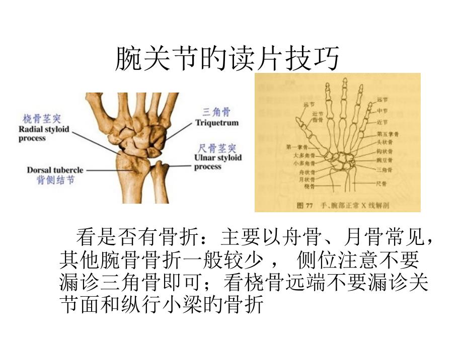 腕关节阅片技巧_第1页