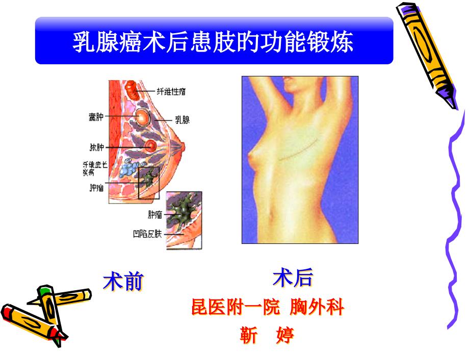 乳腺癌术后的功能锻炼专家讲座_第1页