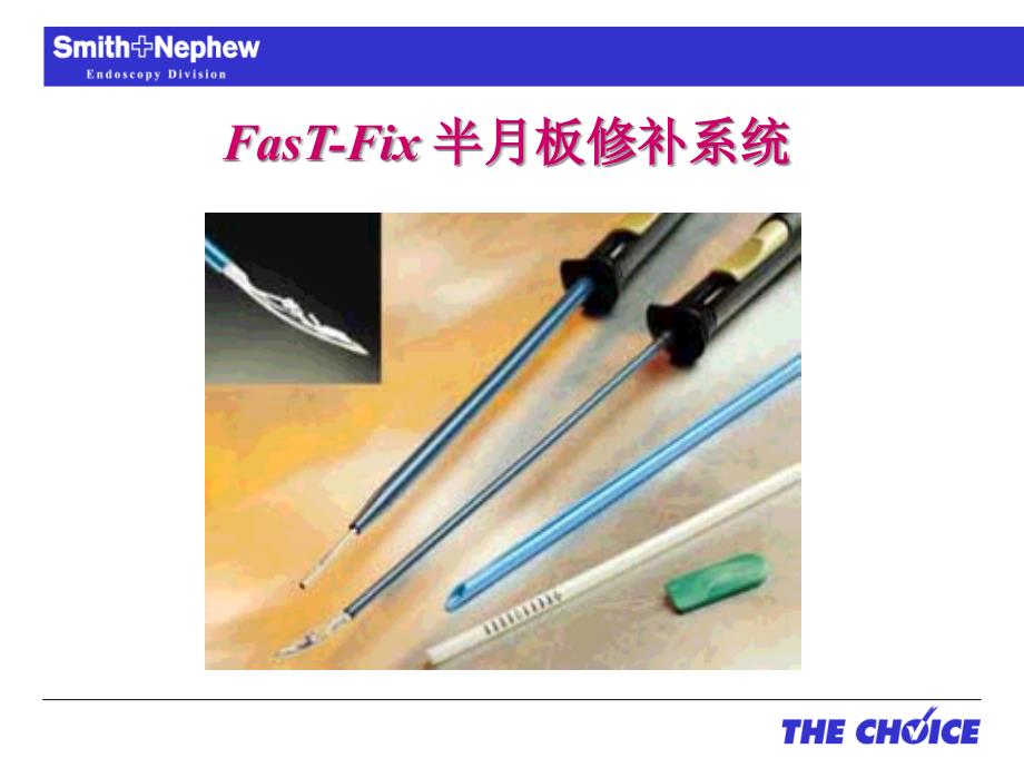 FasTFix半月板修补系统医学知识讲解_第1页