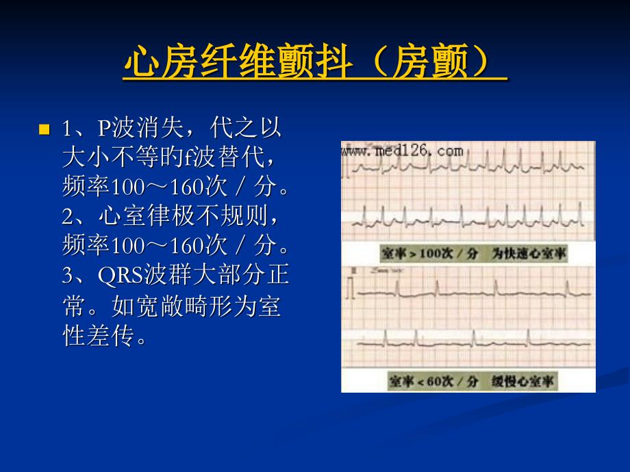 心电图表现专业知识讲座_第1页