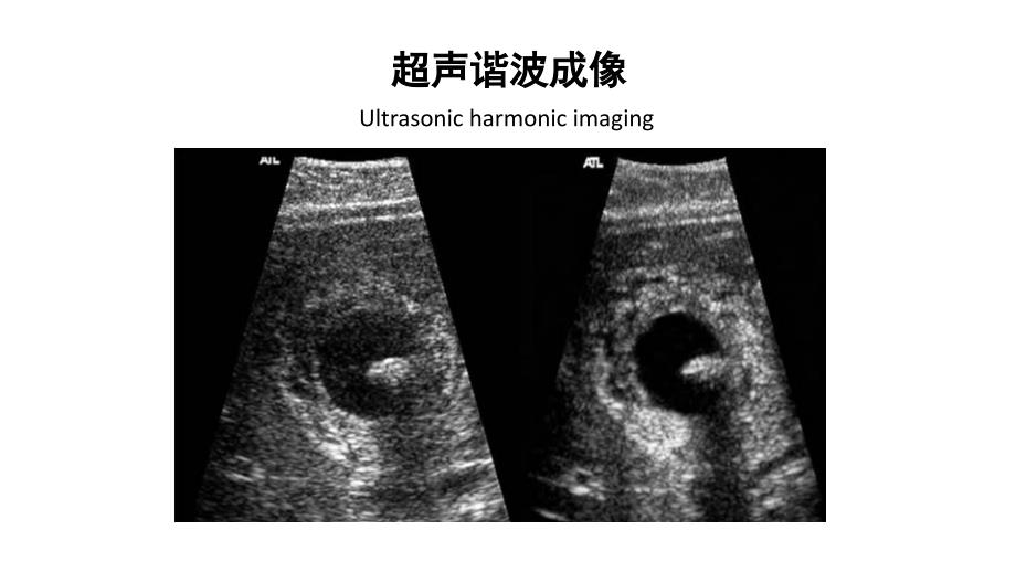 超声谐波成像_第1页