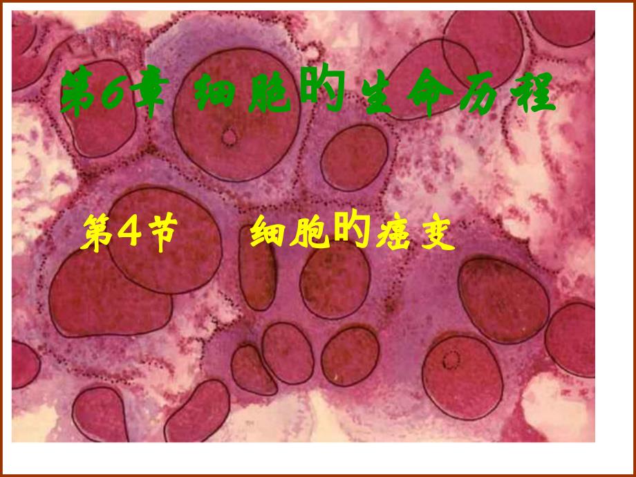 细胞的癌变专题知识讲座_第1页