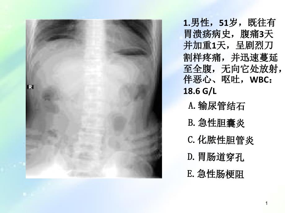 住院医师规陪出科考试辅助检查-PPT_第1页