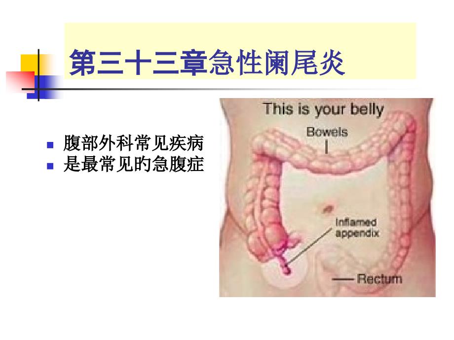 急性阑尾炎主题知识讲座_第1页