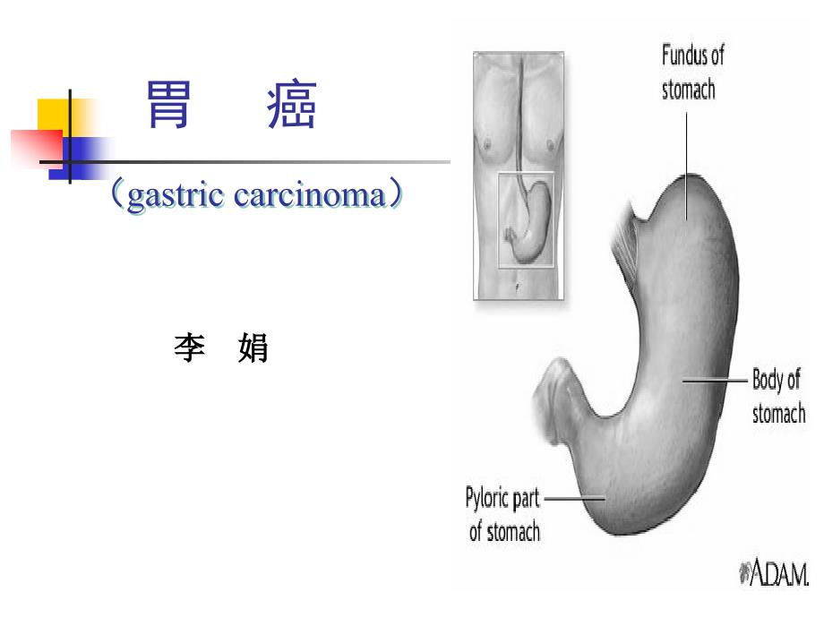 胃癌教学专题知识_第1页