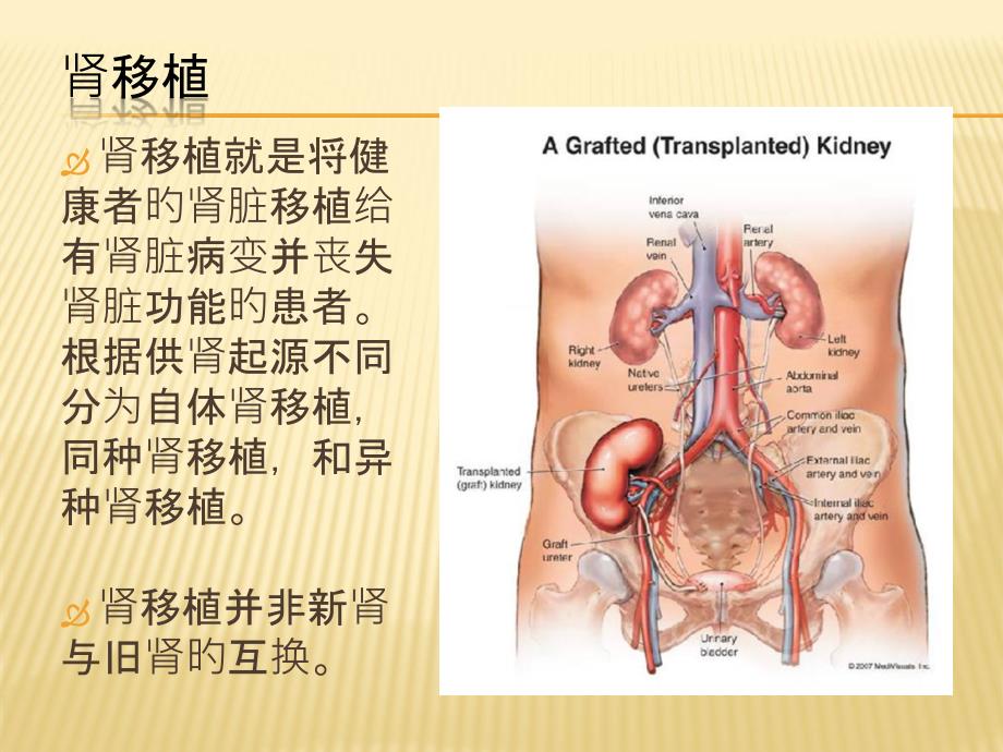 腎移植簡介專題知識(shí)專家講座_第1頁