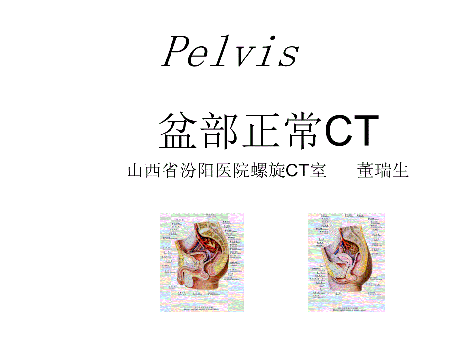 盆部正常CT解剖-PPT_第1页