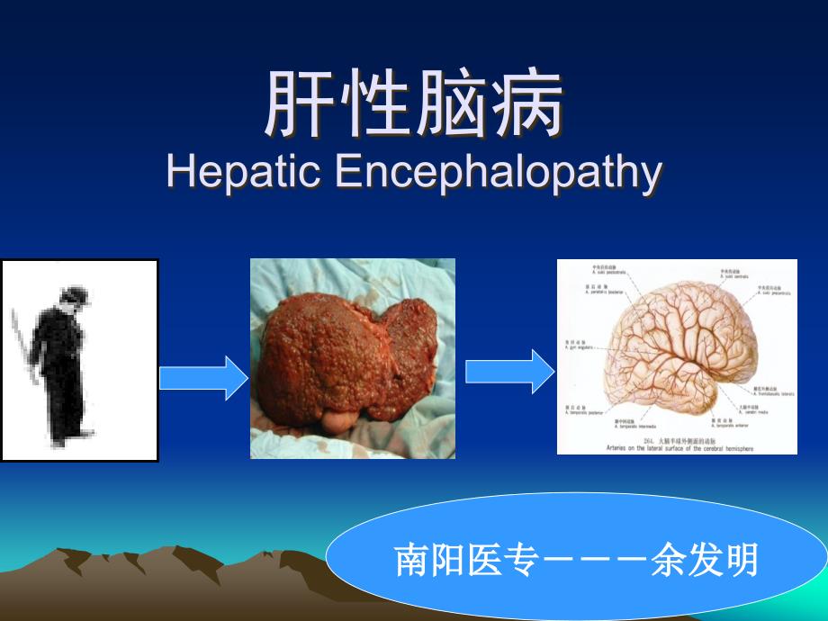 肝性脑病专业知识_第1页