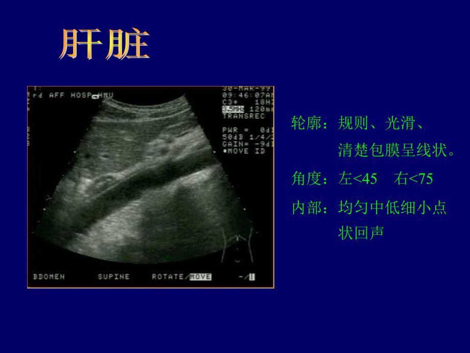 常见病B超专业知识讲座_第1页