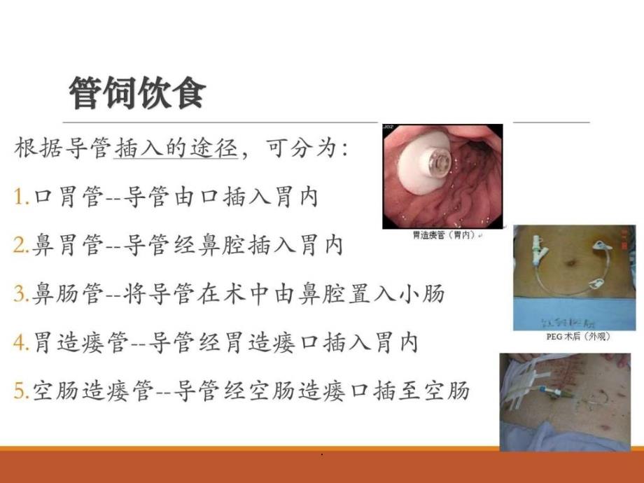 医院饮食与胃肠道护理课件_第1页