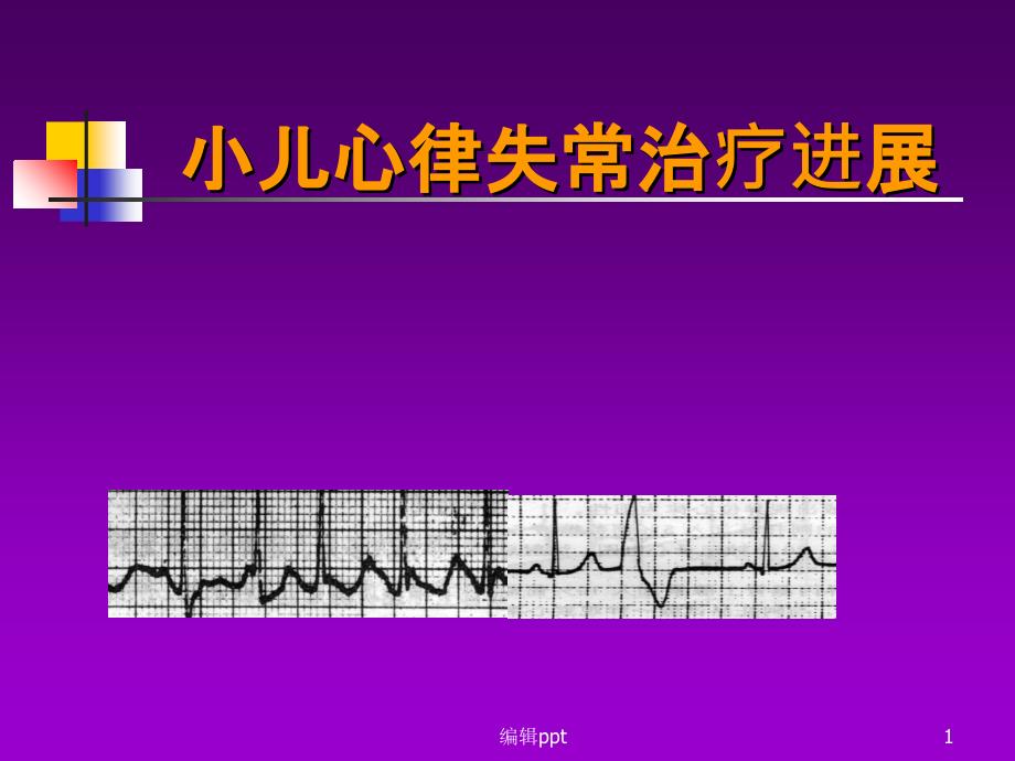 小儿心律失常治疗进展课件_第1页