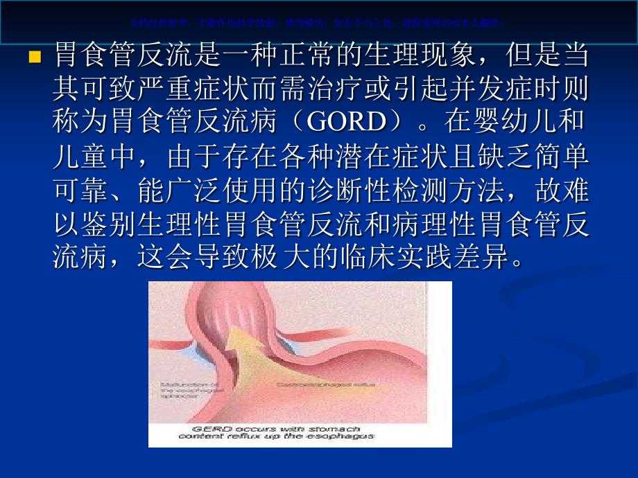 NICE指南儿童胃食管反流病课件_第1页