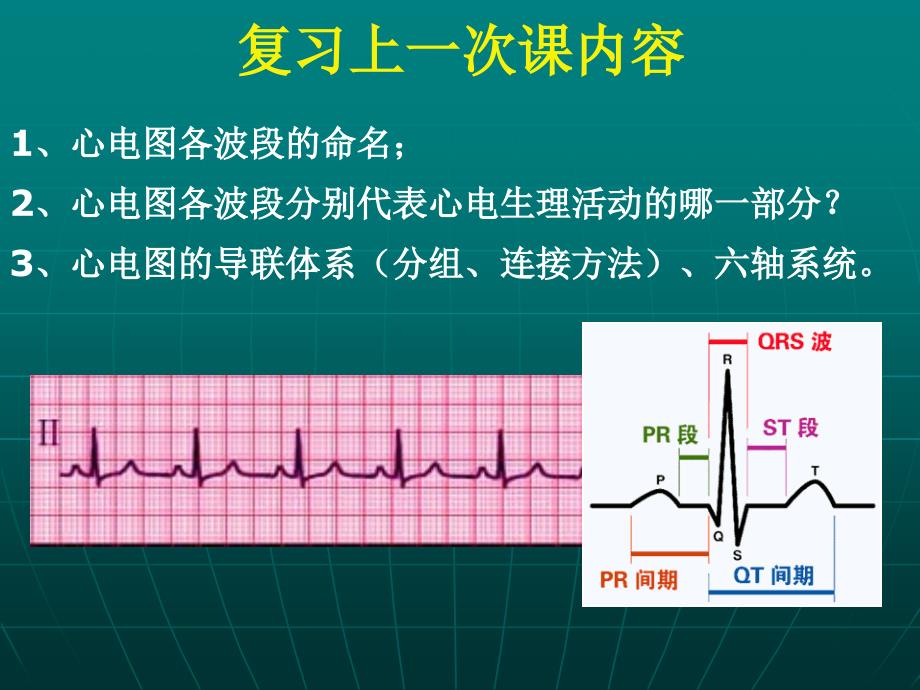 正常心电图及测量(2h)课件_第1页