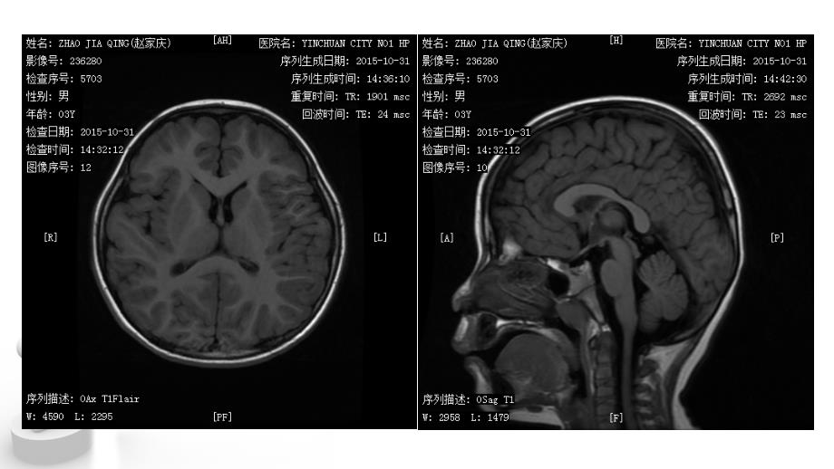 mri简介针对实习生课件_第1页