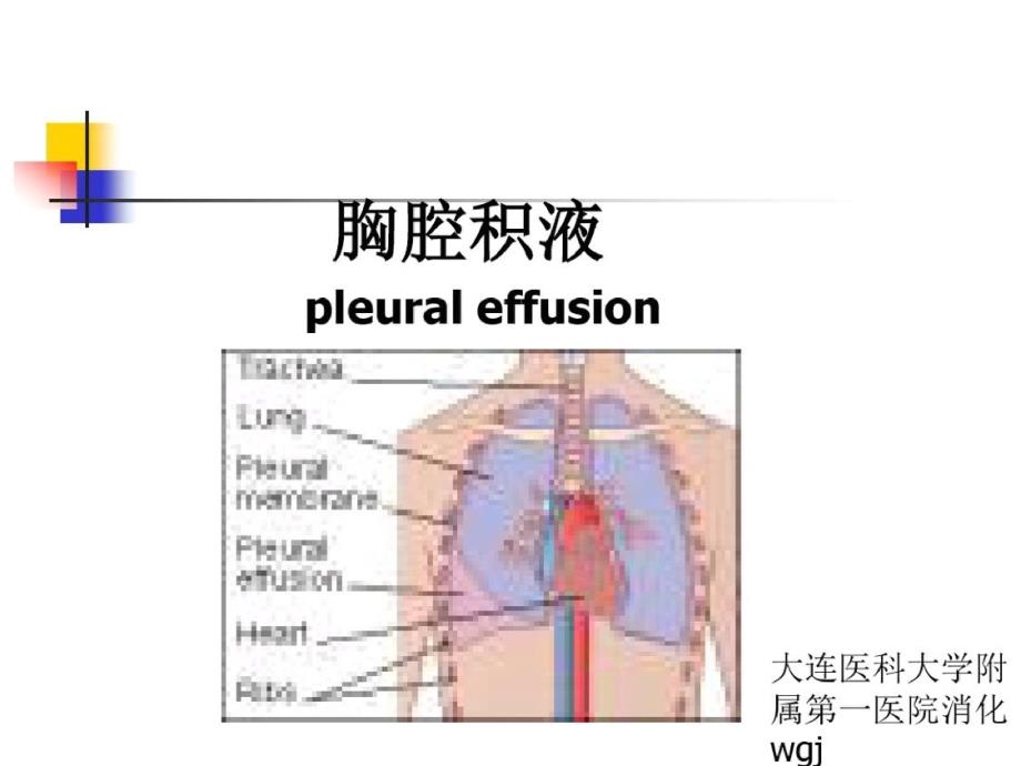 胸腔积液课件_第1页