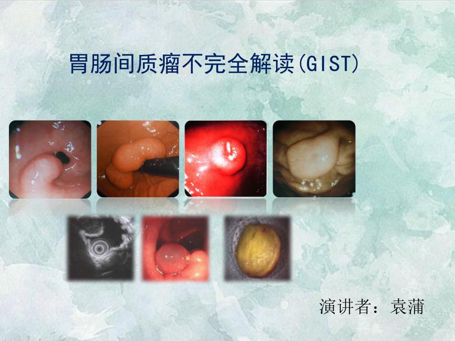 课程资料：胃肠道间质瘤的不完全解读-袁浦课件_第1页