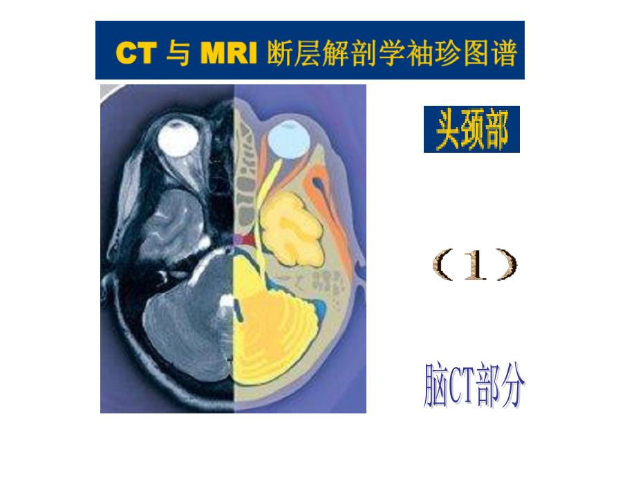 头颈CT-MRI解剖图解第一季_第1页